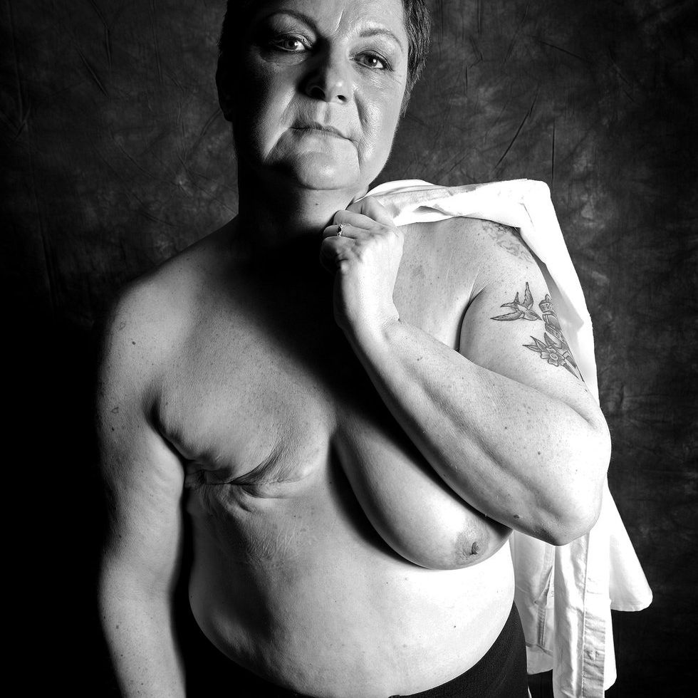 Breast cancer survivor proudly shows off her flat chest and mastectomy  scars in topless photos